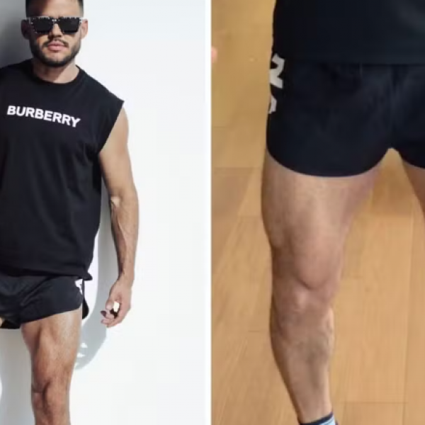 Academia é condenada após constranger aluno por roupa