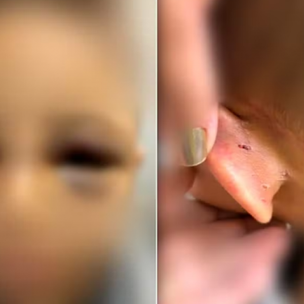 Pai é preso suspeito de espancar filho de 6 anos em Goiânia