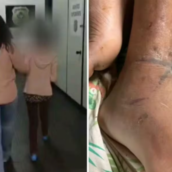Homem acorrentado pela mãe em Goiás sofreu três AVCsv