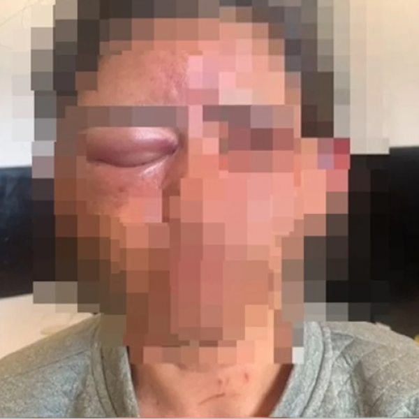 Mulher é estrangulada com toalha após invasão de casa em Cristalina