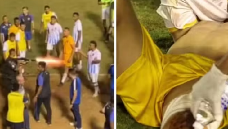 Goleiro baleado por PM em jogo será indenizado em R$ 97 mil