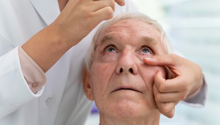 Glaucoma avança sem sintomas e pode causar cegueira